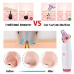 Blackhead Instrument Electric Suction Facial Washing Instrument Beauty Acne Cleaning Blackhead Suction Instrument